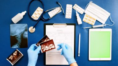 Doktorlar masası, mavi arka plan üzerinde üst görünüm, tıp kavramı