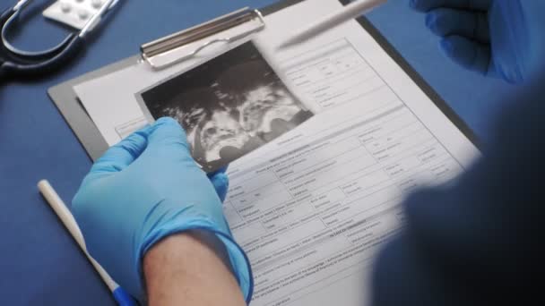 Escritorio de médicos, vista superior sobre fondo azul, concepto de medicina — Vídeo de stock