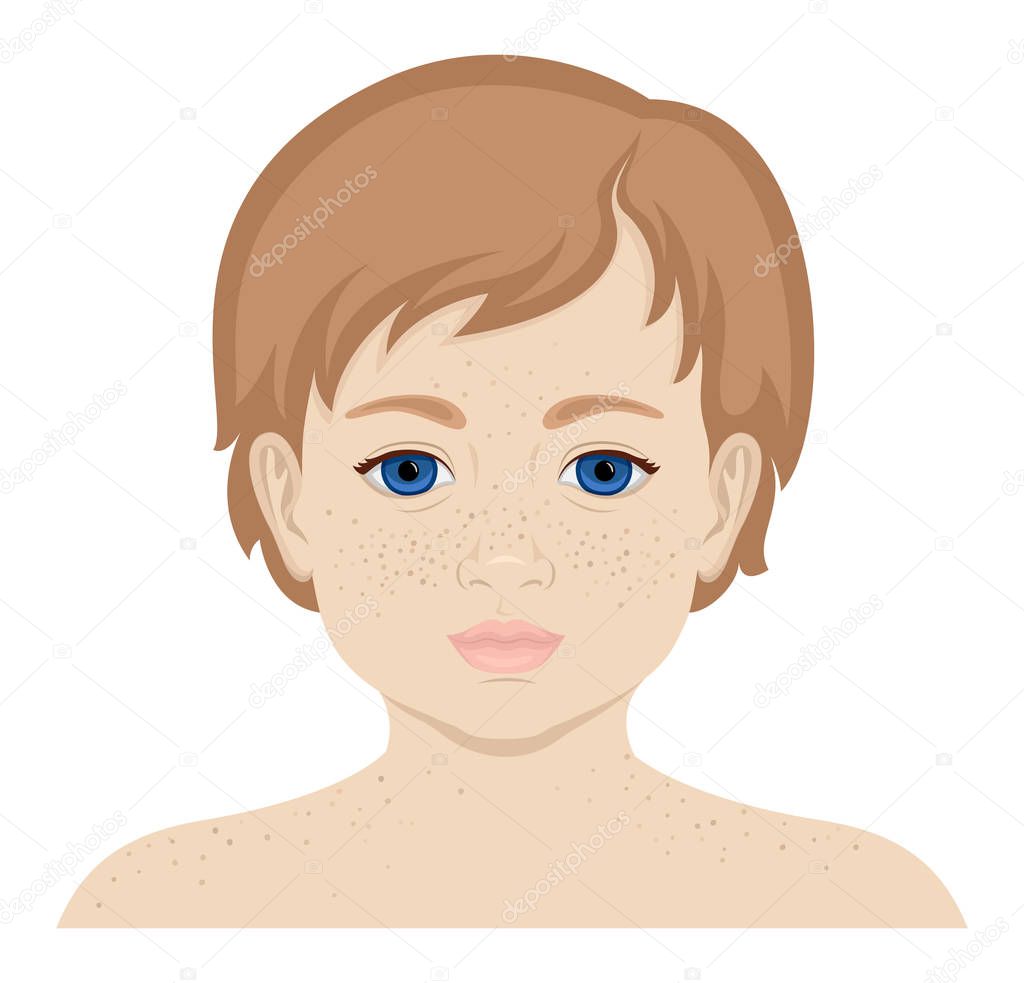 A little blue-eyed girl with freckles on her face and shoulders