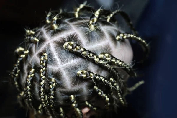 Scatole Problemi Africani Sui Capelli Con Primo Piano Quadrati Grandi — Foto Stock