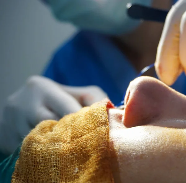 Close Nose Surgery Procedure Hospital — Stock Photo, Image