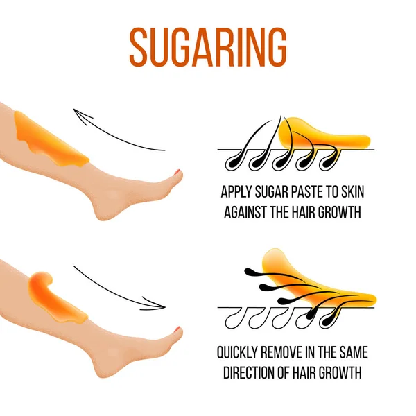 Epilasyon ve sugaring. Epilasyon. folikül. Şeker ya da balmumu ile kadın bacak. Önce ve sonra. Süreci ve Depilasyon adımlardan. vektör çizim