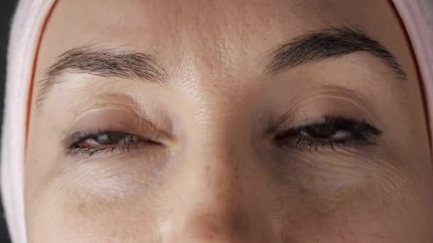Primer plano de la cara femenina joven caucásica antes del procedimiento cosmético. Mujeres ojos constantemente mirando en diferentes direcciones . — Vídeos de Stock
