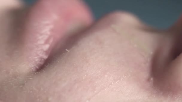 Extremadamente cerca, depilación dolorosa de una cara femenina, tiras de cera adhesiva — Vídeo de stock