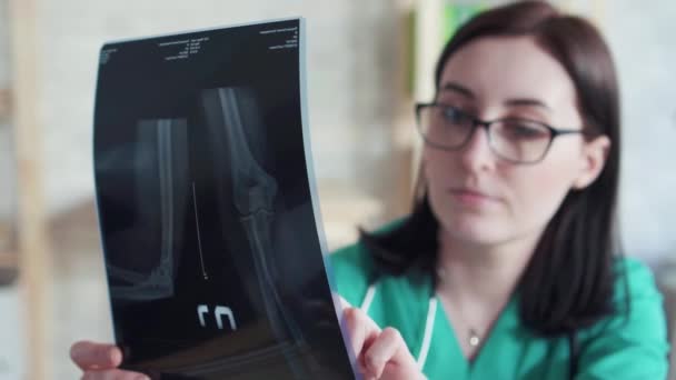 Dokter vrouw kijkt naar de x-ray foto slow mo — Stockvideo