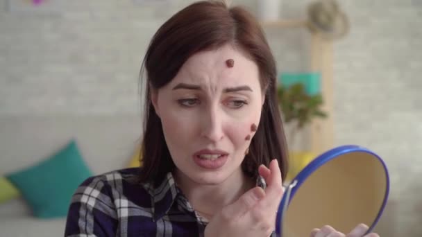 Joven mujer molesta con lunares en su cara mirando en el espejo — Vídeos de Stock