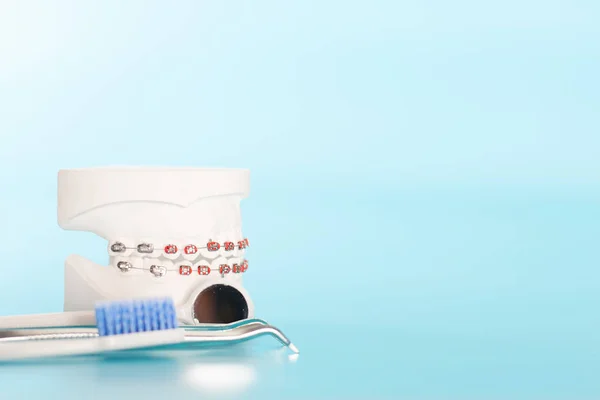 Modello Odontoiatrico Ortodontico Nel Concetto Salute Orale — Foto Stock