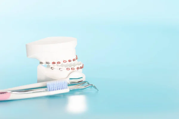 Orthodontic dental model in oral health concept.