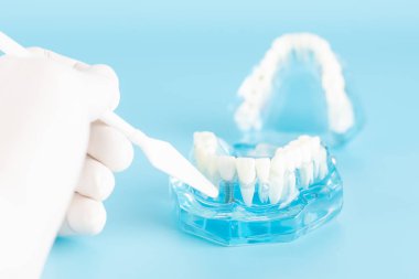 Ağız sağlığı konseptinde diş implantı kontrolü.
