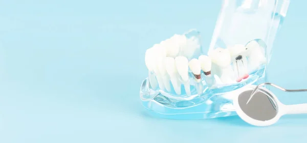 Controllo Dentale Con Modello Dentale Nel Concetto Assistenza Sanitaria Orale — Foto Stock