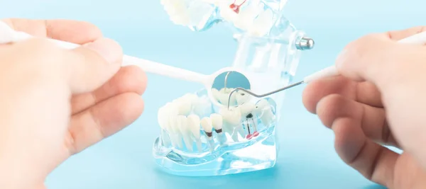 Dental Check Upp Med Dental Modell Oral Vård Koncept — Stockfoto