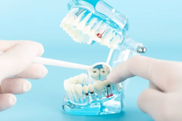 Sözlü sağlık kavramı diş modeli ile diş hesabı.