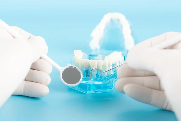 Ağız sağlığı konseptinde diş implantı kontrolü.
