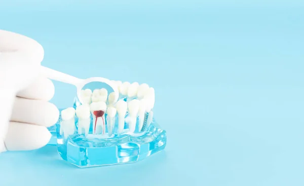 Controllo Dentale Con Modello Dentale Nel Concetto Assistenza Sanitaria Orale — Foto Stock