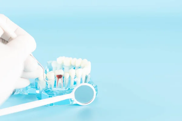 Controllo Dentale Con Modello Dentale Nel Concetto Assistenza Sanitaria Orale — Foto Stock