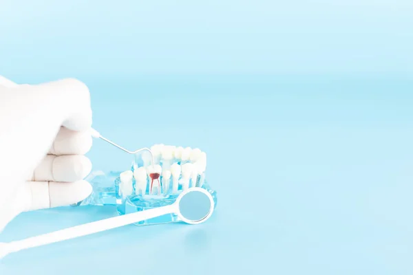 Tandheelkundige Check Met Tandheelkundige Model Model Mondelinge Gezondheidszorg Concept — Stockfoto