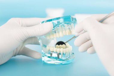 Diş bakımı konseptinde modelli diş aleti.