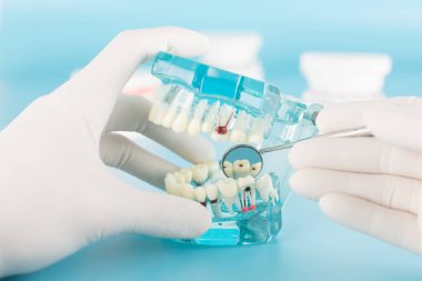 Diş bakımı konseptinde modelli diş aleti.