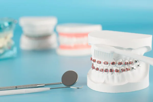 Herramienta Dental Con Modelo Concepto Cuidado Dental — Foto de Stock