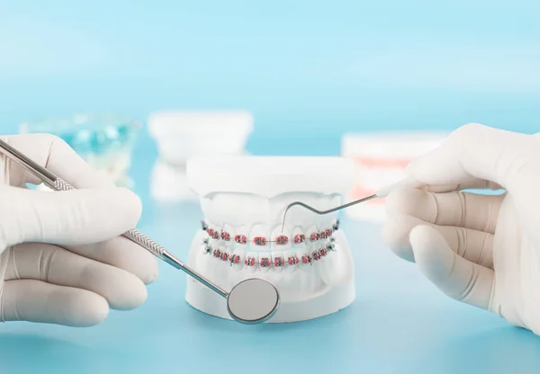 Tandheelkundige Tool Met Model Dental Care Concept — Stockfoto