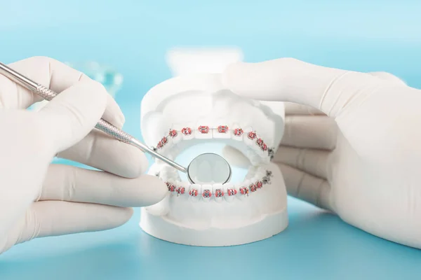 Tandheelkundige Tool Met Model Dental Care Concept — Stockfoto