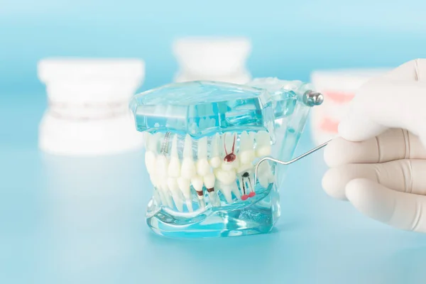 Tandheelkundige Tool Met Model Dental Care Concept — Stockfoto