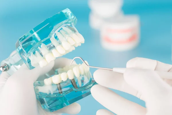 Zubní Nástroj Modelem Pro Zubní Péči — Stock fotografie