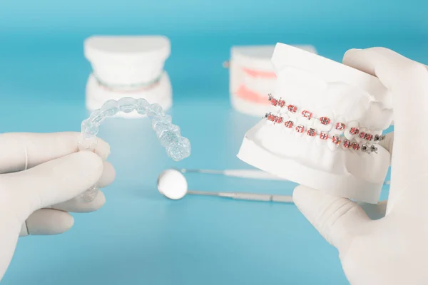 Helder Orthodontisch Model Tandheelkundige Zorgconcept — Stockfoto