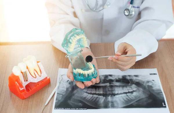 Diş implantı modeli ile diş hekimi.