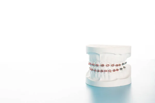 Μοντέλα οδοντικών άγκιστρα σε λευκό φόντο. — Φωτογραφία Αρχείου