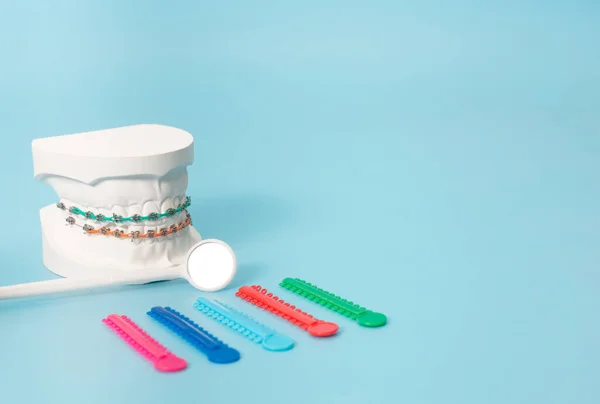 Приклади Стоматологічних Моделей Ортодонтичних Моделей Білої Штукатурки Прикріпіть Брекети Руки — стокове фото