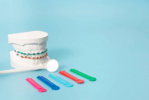 Voorbeelden Van Tandheelkundige Modellen Orthodontische Modellen Gemaakt Van Wit Gips — Stockfoto