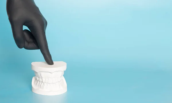 Esempi Modelli Dentali Ortodontici Realizzati Gesso Bianco Attaccare Apparecchio Mani — Foto Stock