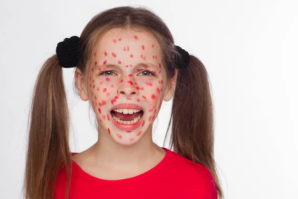 Vista frontal de uma menina com um problema erupção cutânea — Fotografia de Stock