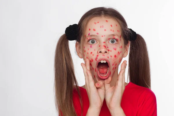 Vista frontal de uma menina com um problema erupção cutânea — Fotografia de Stock