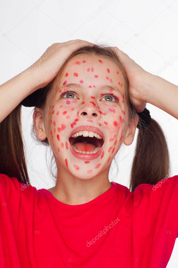 Front view of a girl with a problem skin rash