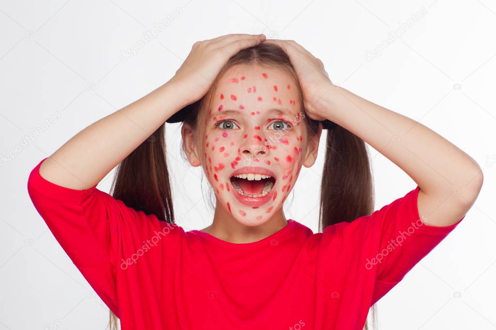 Front view of a girl with a problem skin rash
