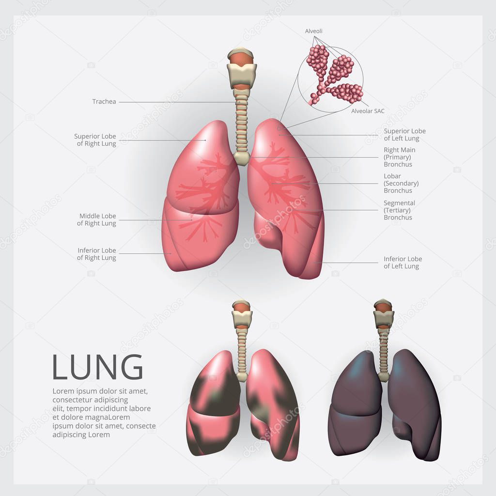 Lung with Detail and Lung Cancer Vector Illustration