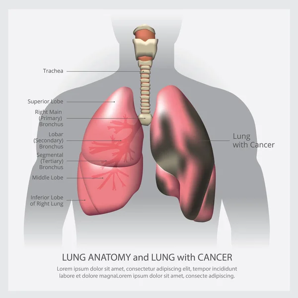 Detaylı Akciğer Akciğer Vektörü Llüstrasyonu — Stok Vektör