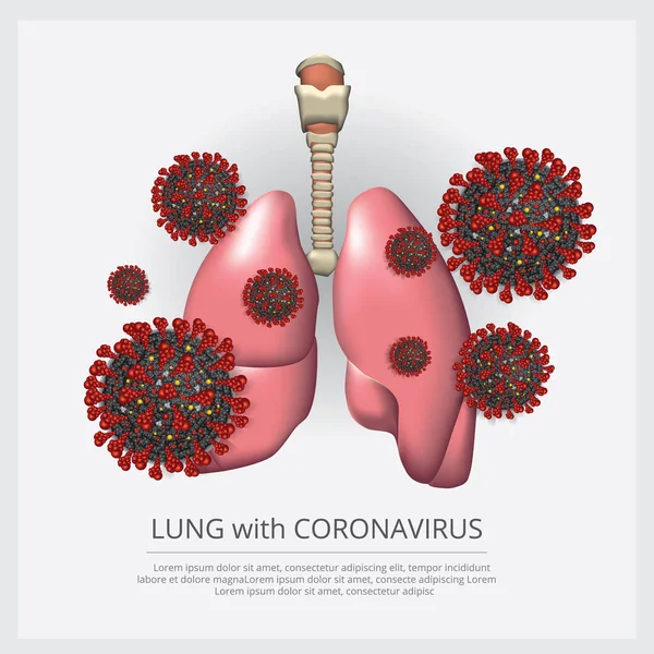 Lung Corona Virus 2019 Ncov Vector Illustration — 스톡 벡터