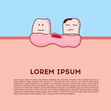 Düzen Çürükler ve kavite dişler mavi arka plan üzerinde illüstrasyon vektör. Diş çekimi. Diş konsepti.