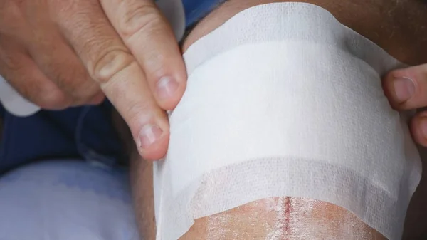 Medico Mettere una fasciatura nuova e pulita su un piede ferito in ospedale — Foto Stock