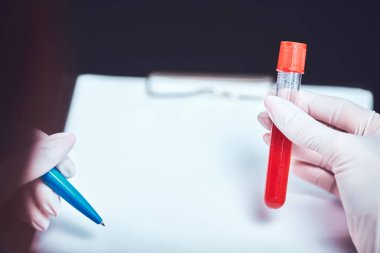 Virüsler, mantarlar ve hastalıklar için tıbbi testler.