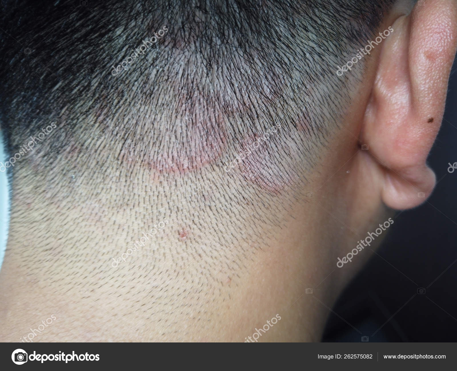 Qual a importância dos fungos para o planeta Terra? | National Geographic |  National Geographic, image size:1600x1300