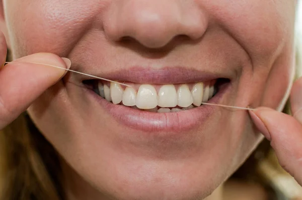 Jeune Fille Fil Dentaire Ses Dents — Photo