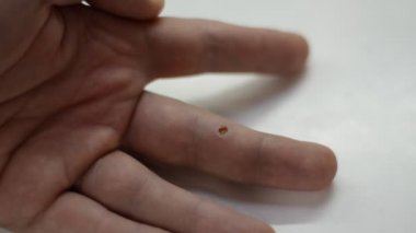 Doktor kolundaki yarayı iyotla tedavi ediyor.