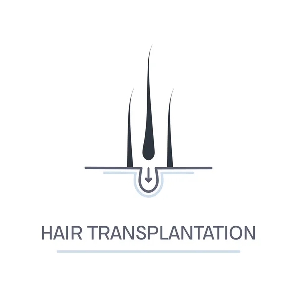 Vlasy transplantace folikul symbol pro léčbu alopecie — Stockový vektor