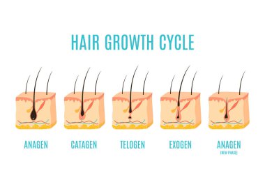 Hair growth cycle medical educational poster. Skin ross-section showing a hair follicle in anagen, telogen and catagen phases. Removal, treatment and transplantation concept. Vector illustration. clipart