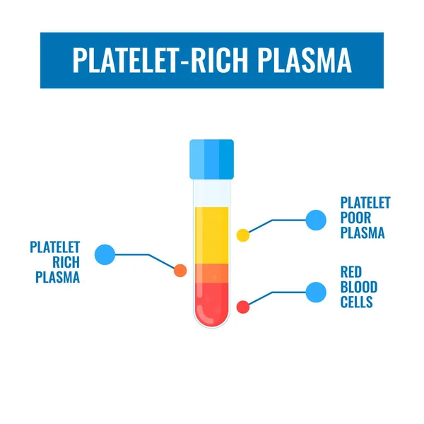 Thrombocyta-gazdag plazma a PRP-eljárás tesztcsövezéséhez — Stock Vector