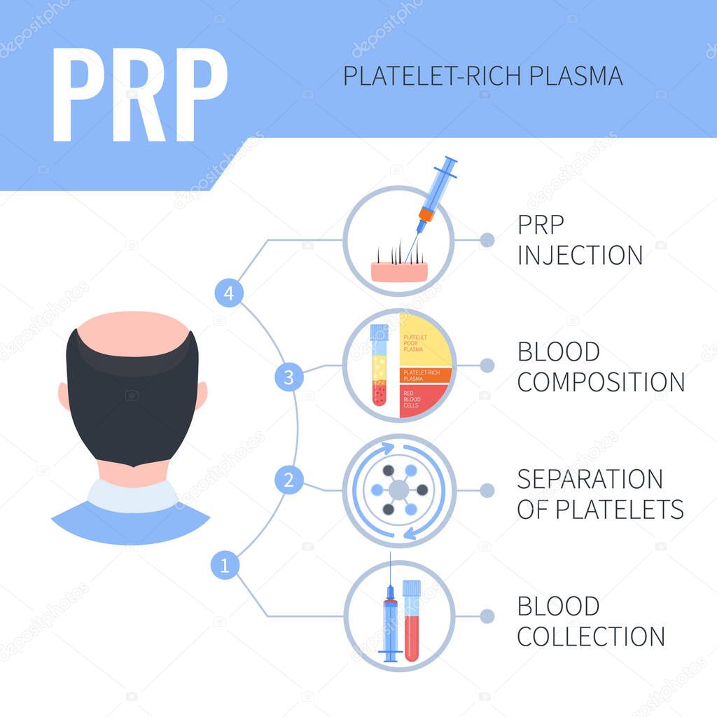PRP hair regrowth therapy infographics for men